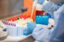 Price of the CDC coronavirus test: $36 Price of the CDC coronavirus test: $36
